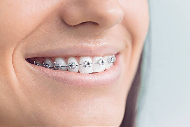 Why Choose Us for Your Dental Needs in Concord, AL